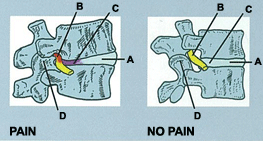 Advanced Chiropractic